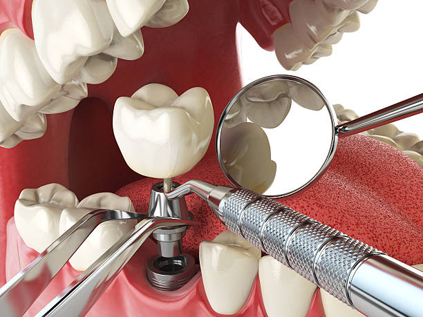 Best Cracked Tooth Emergency Dentist  in Long Neck, DE